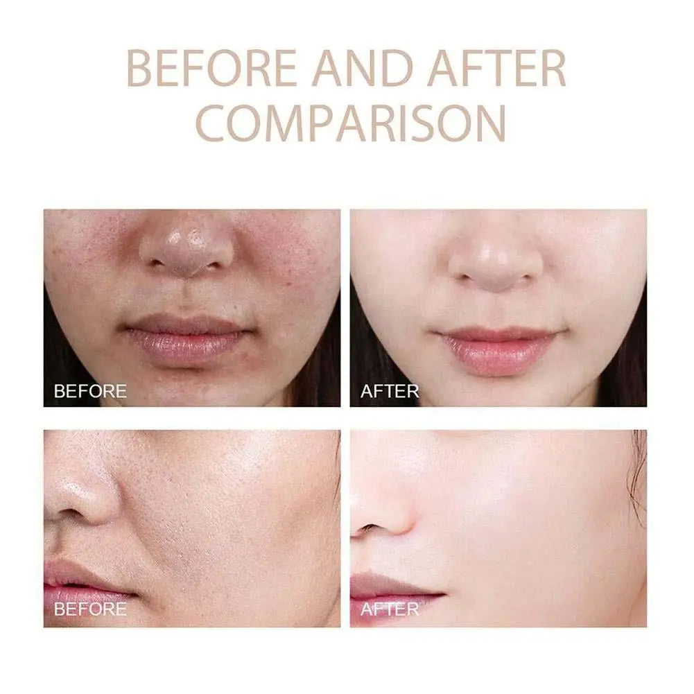 Radiant Renewal Essence™