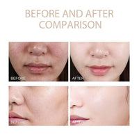 Dr. Melaxin Peel Shot White and Black Rice Exfoliating Essence Skin Lightening Contro Moisturizing Oil-Control Gentle Skin Care